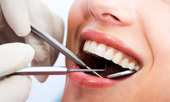 Image Text: dental_cleanings_exam_3