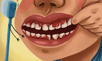 Image Text: gum health, gum disease, signs of gingivitis