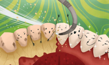 Image Text: deep cleaning aftercare, image of a dental cleaning or deep cleaning removing tartar