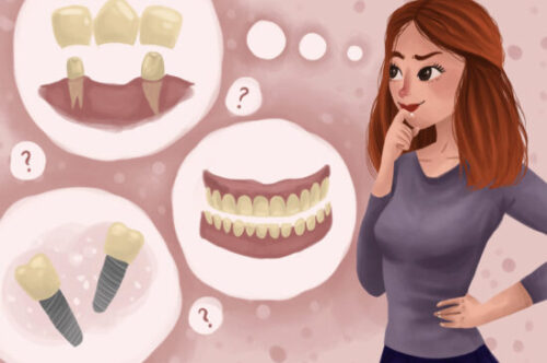 Image Text: woman considering missing tooth replacement with dentures, dental implants, dental bridge
